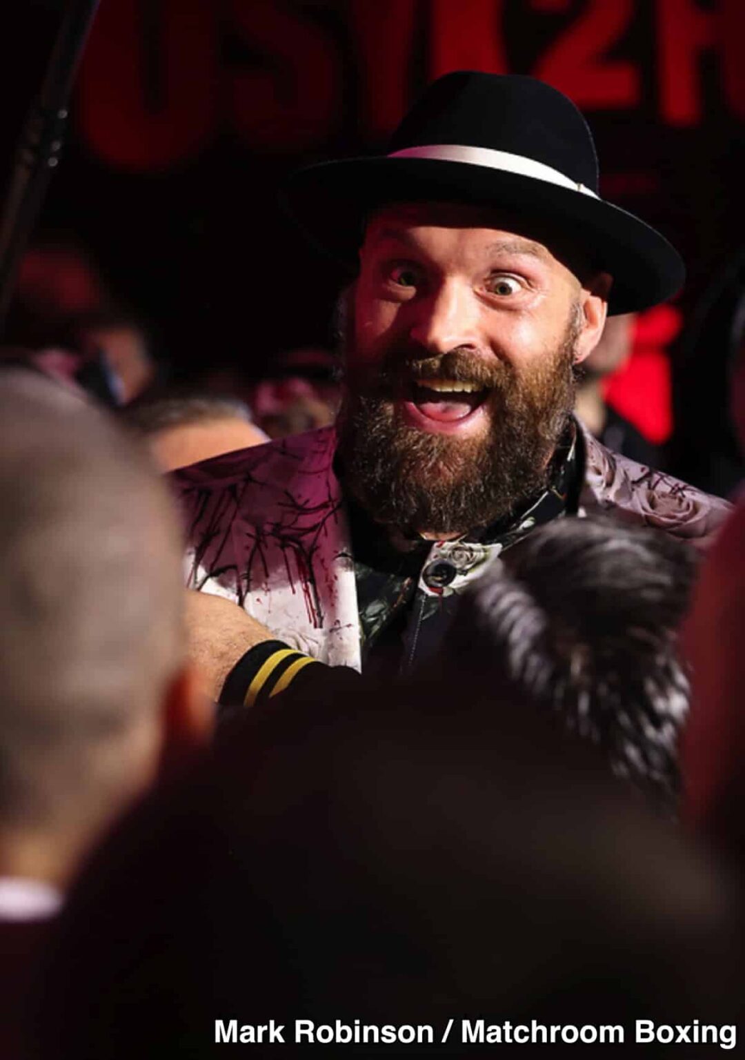 Fury Looks Unhealthy, Cranky Before Usyk Rematch