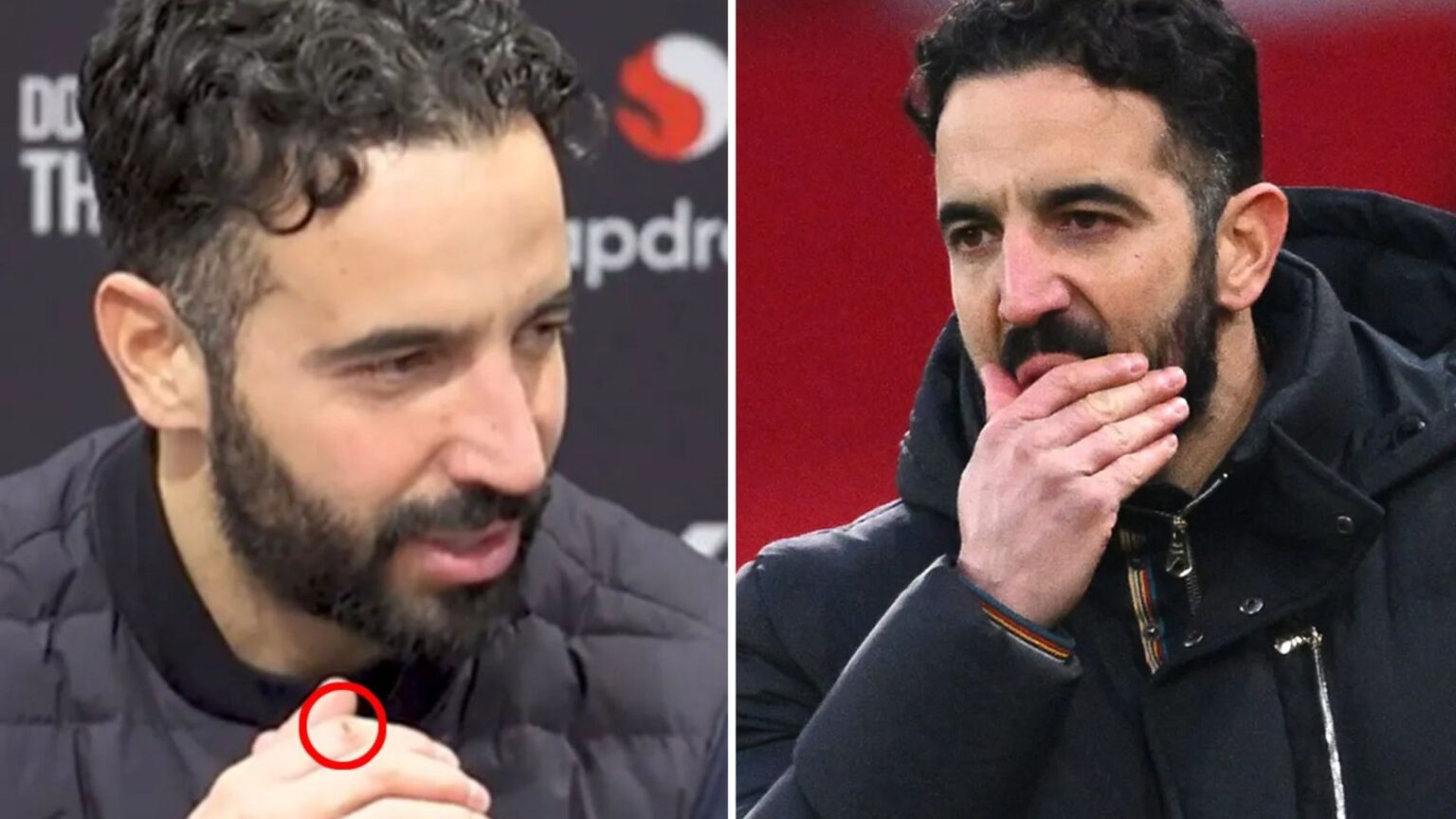 Fans convinced they’ve spotted cut on Ruben Amorim’s finger in interview that gave away Man Utd boss’s furious outburst