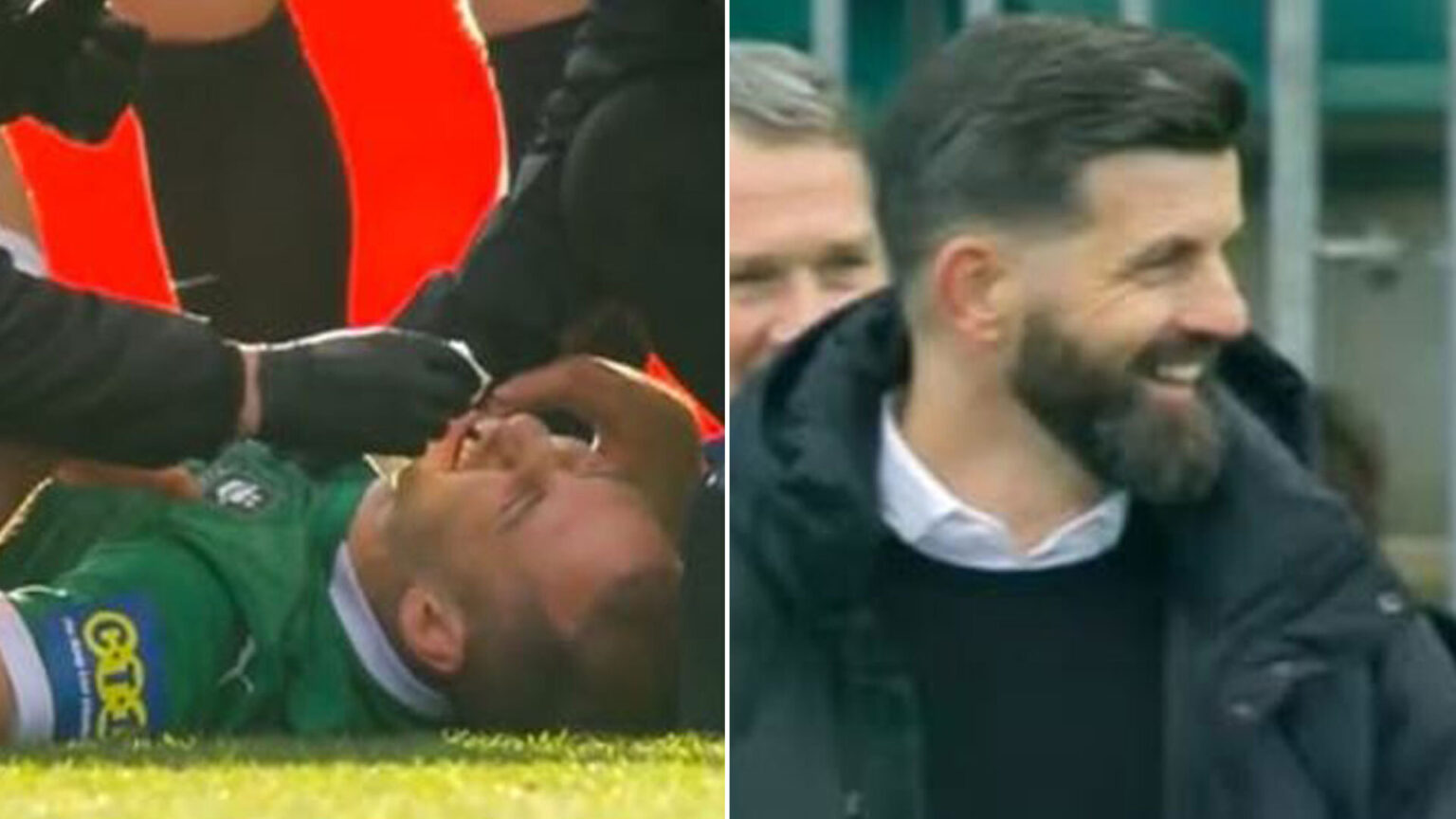 Plymouth manager spotted LAUGHING on the touchline as star loses a tooth in sickening clash with own team-mate