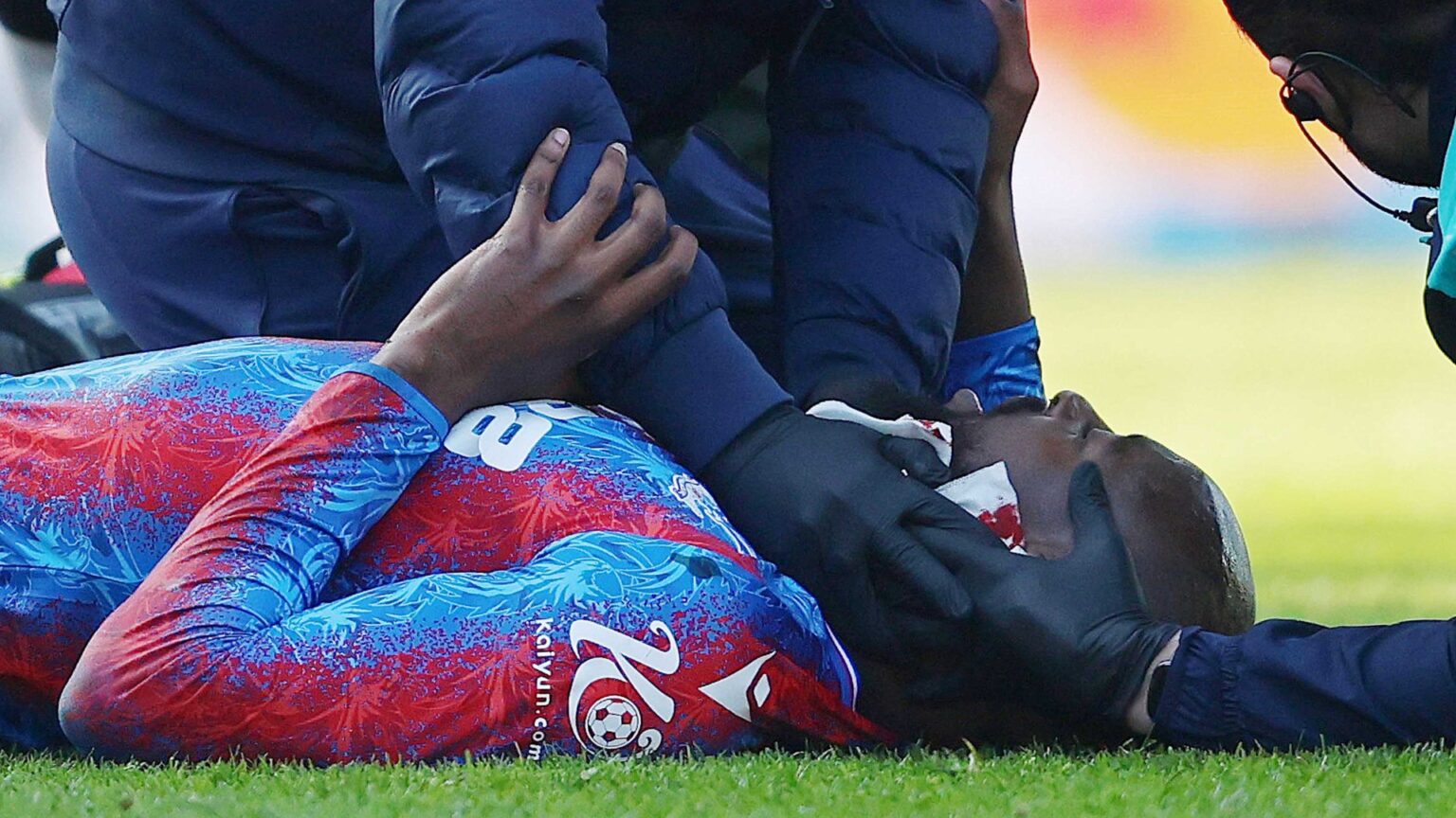 Crystal Palace release Jean-Philippe Mateta injury statement as star leaves hospital after ‘severe laceration to ear’