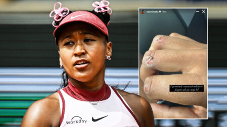 ‘What the f*** is this?’ – Naomi Osaka considers taking break from tennis as she posts pic of nasty hand injury