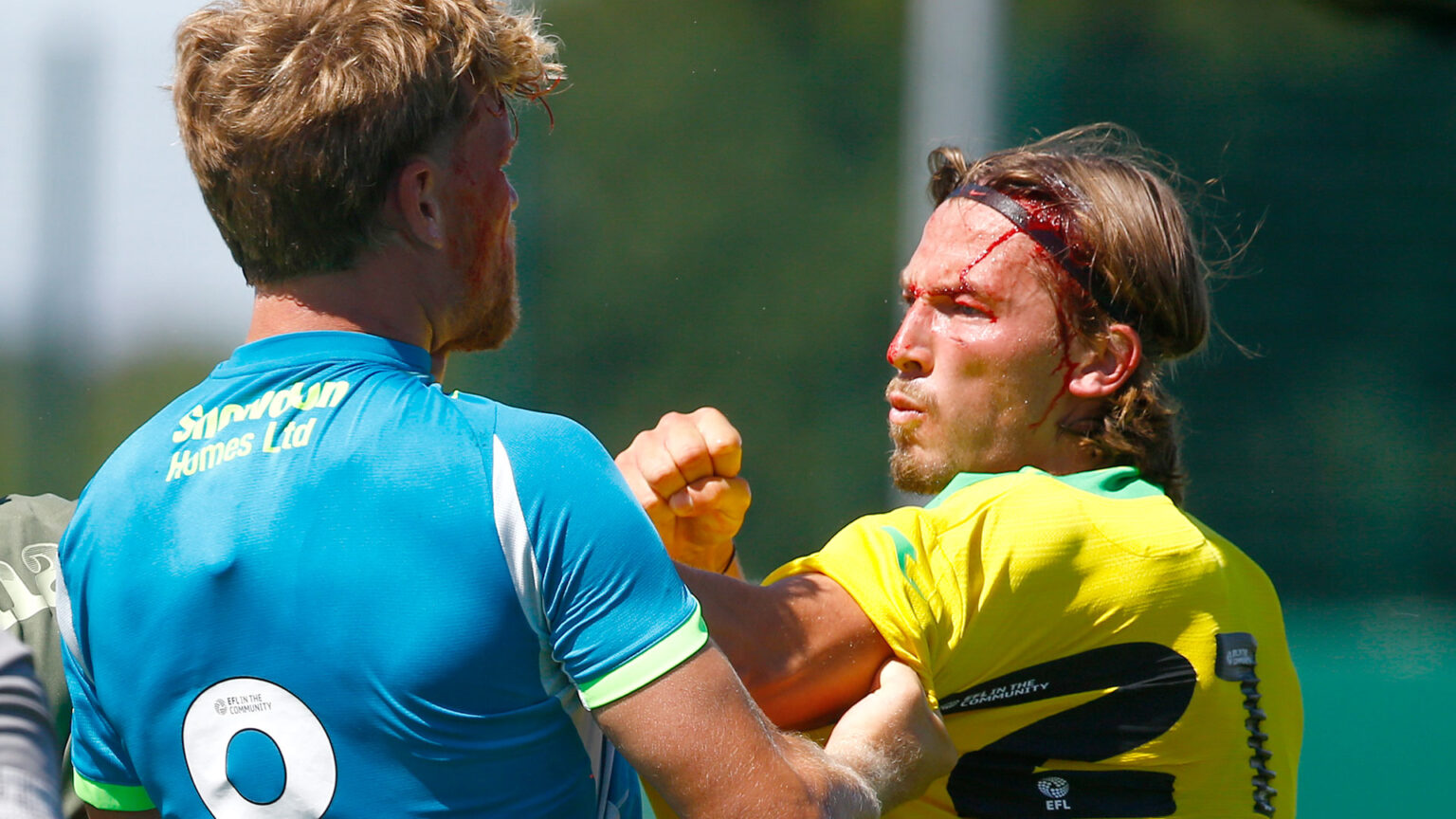 Norwich defender left with bloodied head and pulled apart from Made in Chelsea star’s husband in pre-season friendly
