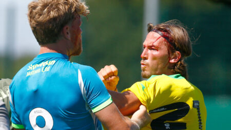 Norwich defender left with bloodied head and pulled apart from Made in Chelsea star’s husband in pre-season friendly