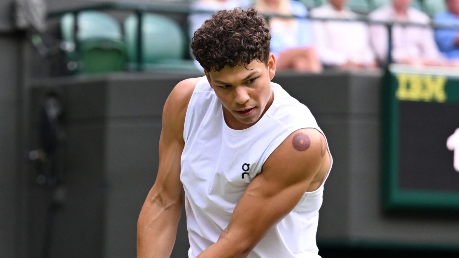 Why does Ben Shelton have red marks on his arms?