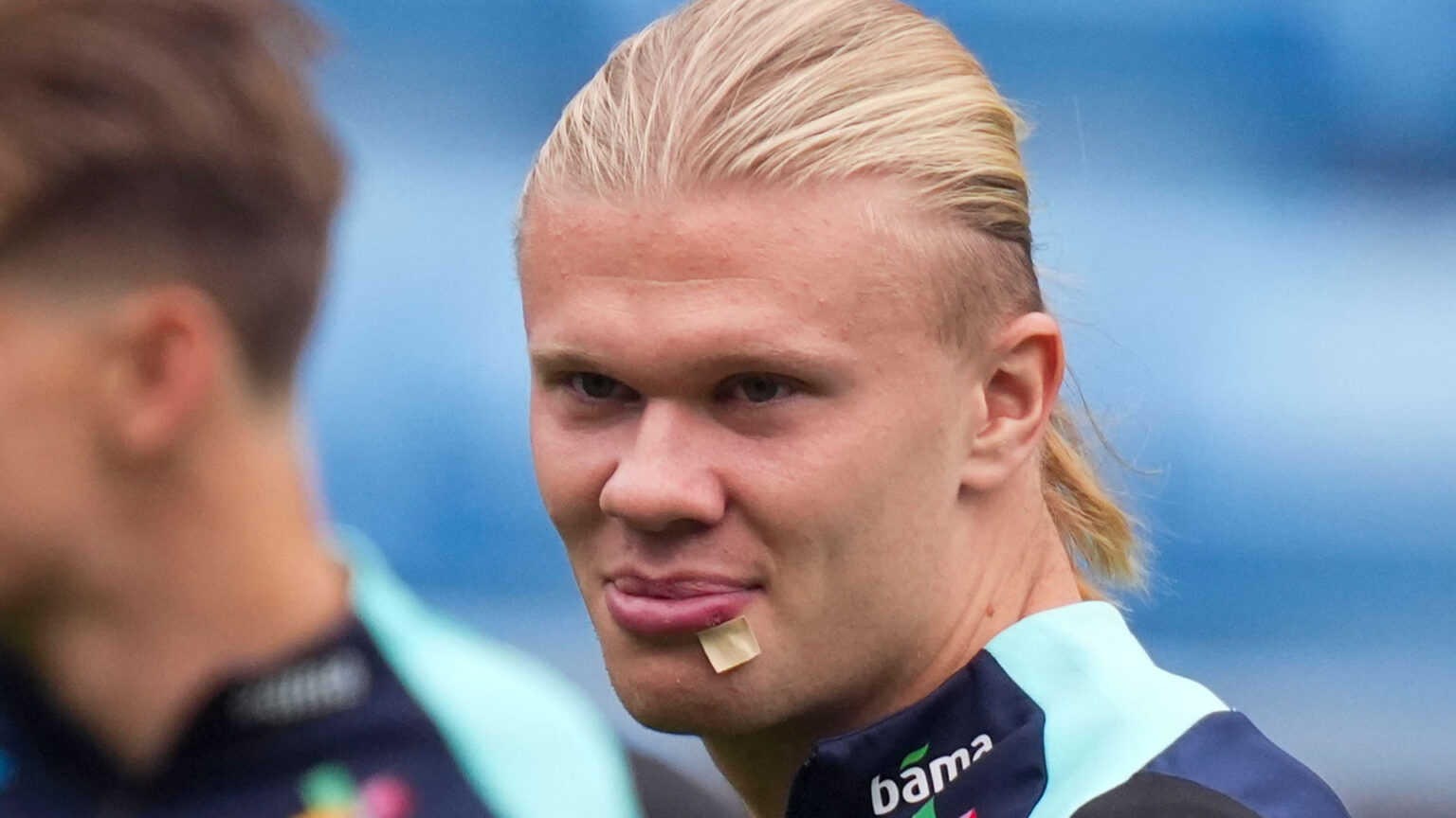 Erling Haaland needed three stitches and emergency visit to dentist after freak bus door injury