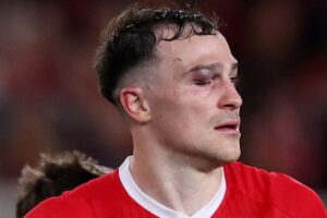Middlesbrough star George Edmundson forced off with huge egg on his eye after sickening clash of heads