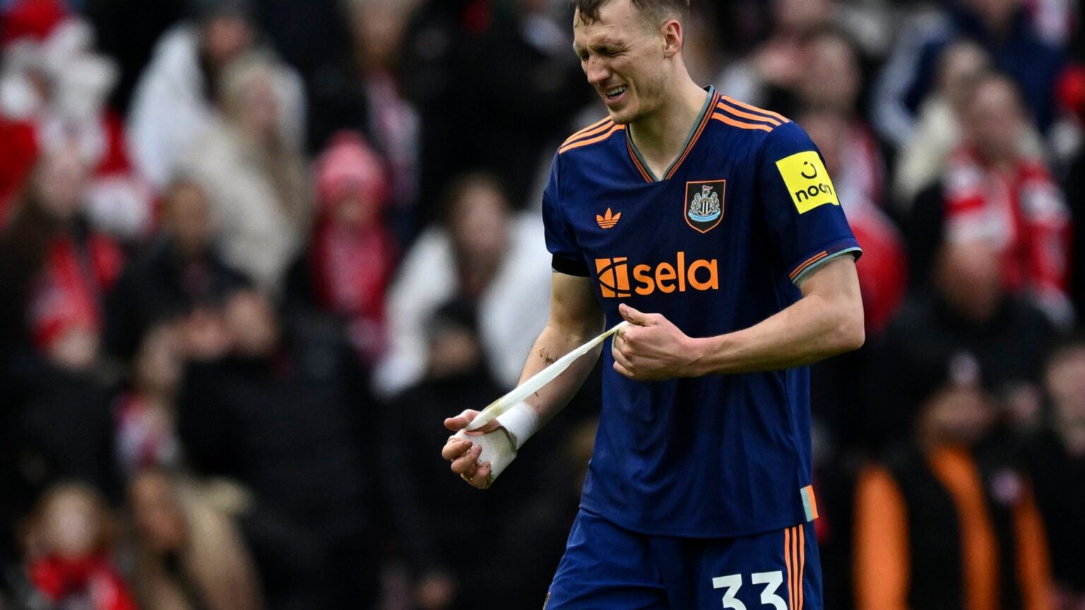 Dan Burn’s horror injuries revealed after Newcastle star was rushed to hospital following sickening collision