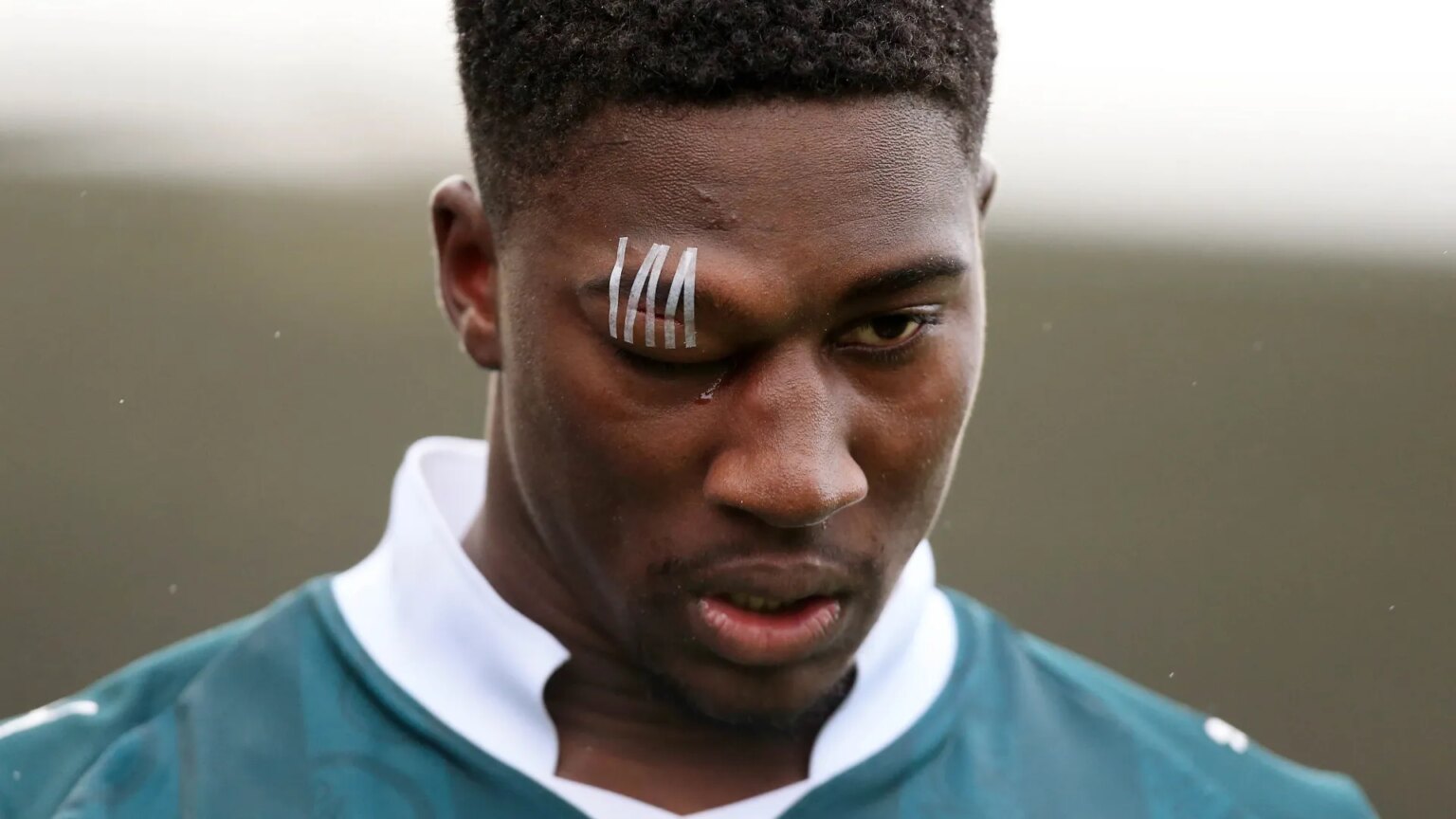Plymouth Argyle star’s eye closes up in horror injury just minutes after scoring wondergoal
