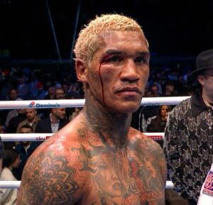 Gareth A. Davies Says Conor Benn Isn’t Same Fighter Gareth A. Davies Says Conor Benn Isn’t Same Fighter