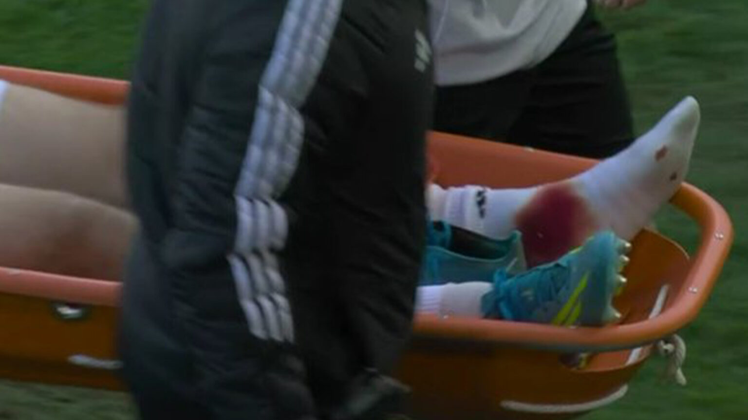 Devastated Leeds star Anton Stach stretchered off with foot covered in blood in huge blow to World Cup hopes Devastated Leeds star Anton Stach stretchered off with foot covered in blood in huge blow to World Cup hopes