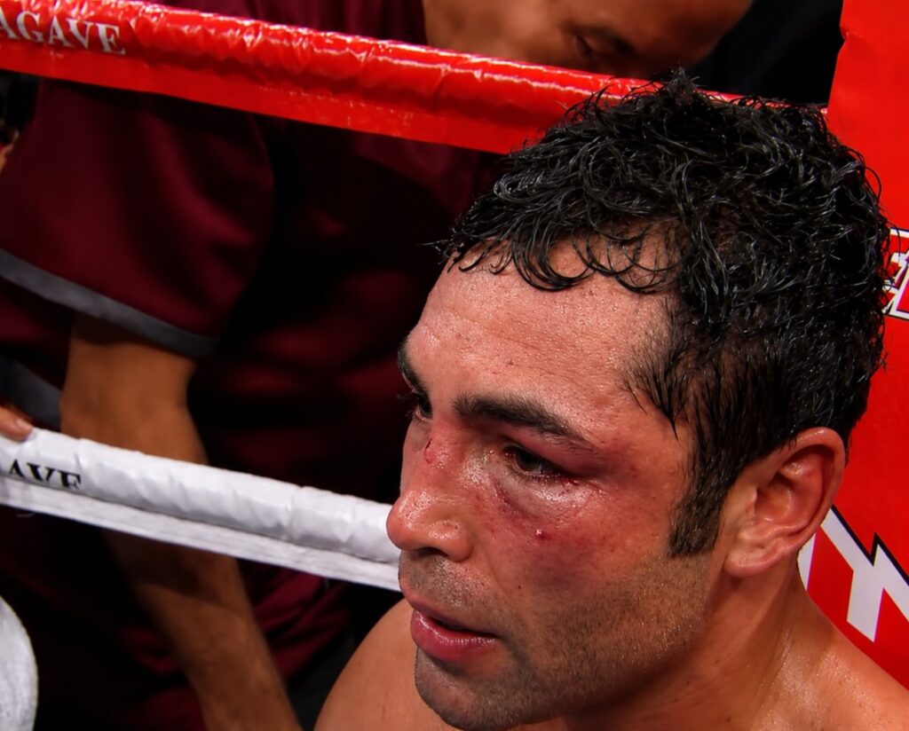 Victor Ortiz’s Oscar De La Hoya Sparring Story Comes With Important Context Victor Ortiz’s Oscar De La Hoya Sparring Story Comes With Important Context