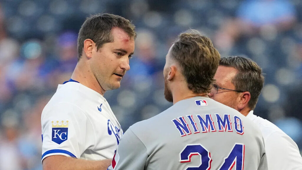 Royals’ Seth Lugo is expected to start Friday after being hit in the head by a line drive Royals’ Seth Lugo is expected to start Friday after being hit in the head by a line drive