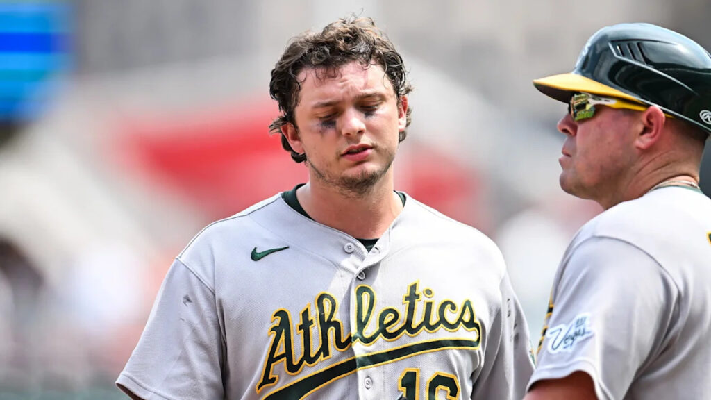 Athletics’ Nick Kurtz could miss the rest of the season with a thumb injury